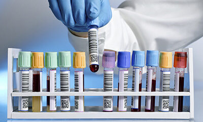 What do the most common pathology tests look for?