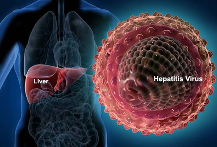 From 230,000 patients to extinct in 15 years: pathology key to defeating hepatitis C