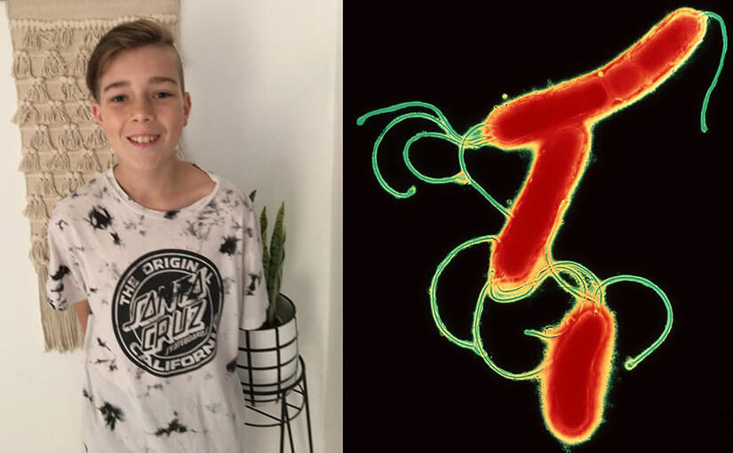 How pathology solved the puzzle of 12-year-old Jay’s pain