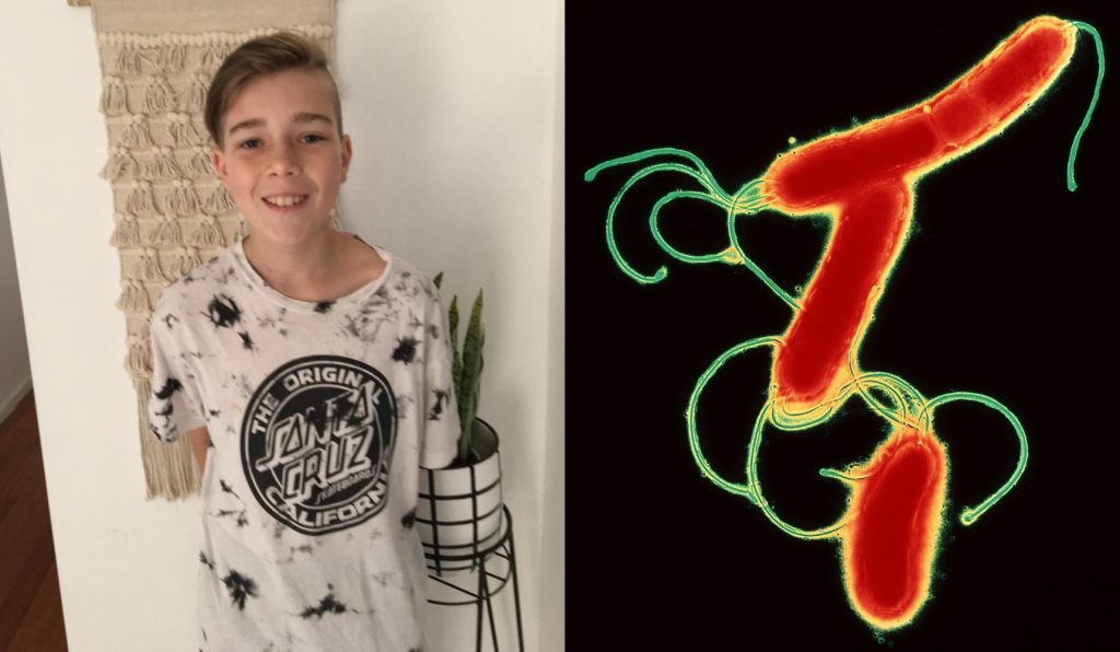 Jay and the H. pylori bacteria that made him sick