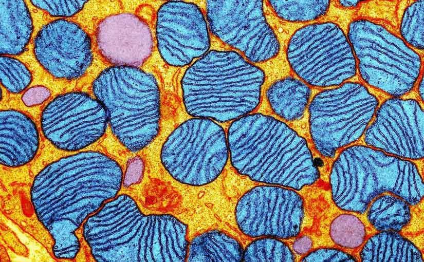 A genetic defect carried by 1 in 200 people – mitochondrial disease
