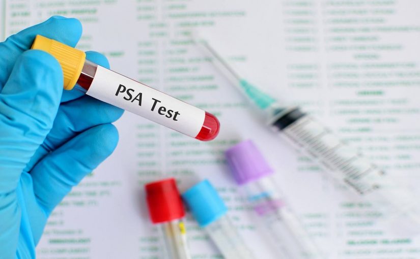 PSA testing – from confusion to consensus