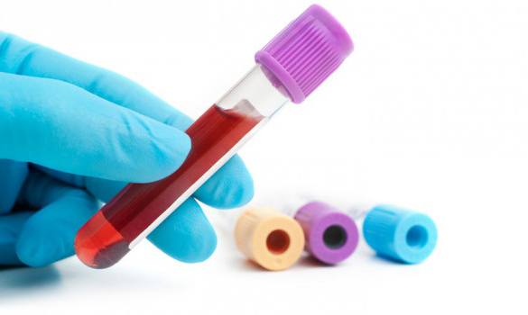 A simple blood test could make it easier to diagnose Polycystic Ovary Syndrome