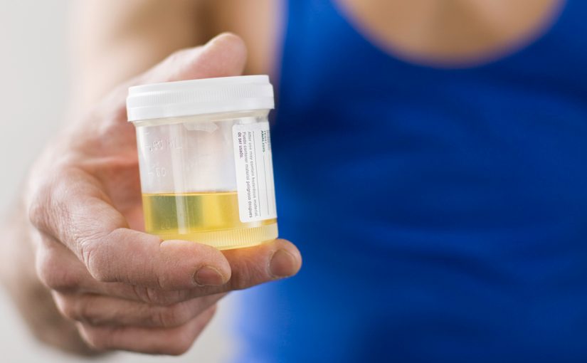Everything you need to know about urine tests