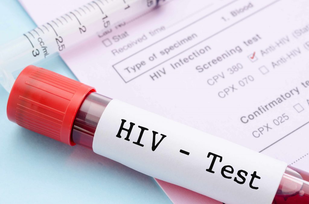 Pathology testing is at the forefront of the HIV fight