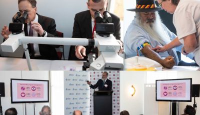 Politicians at the pointy end- learning first hand about diabetes detection