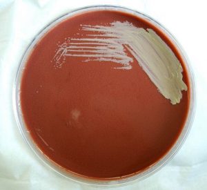 Francisella tularensis bacteria on a plate