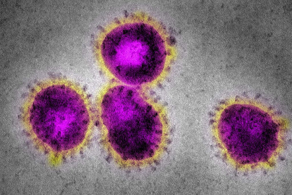 Coronavirus under microscope
