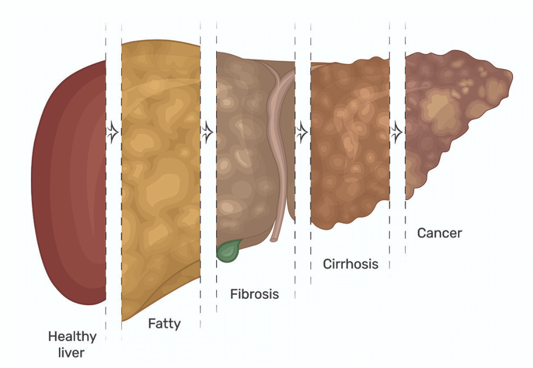 Pathology Explained | Know Pathology Know Healthcare